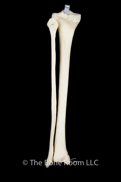 Articulated Human Tibia & Fibula Set